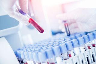 Oboseală, imunitate scăzută, piele uscată? Verifică-ţi nivelul de zinc şi seleniu