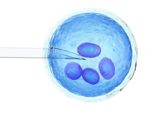 România este singura ţară din Uniunea Europeană care nu sprijină financiar fertilizarea in vitro
