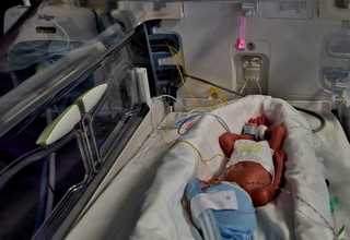  Ziua Internaţională a Prematurităţii, marcată la SUUB