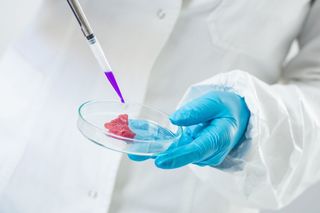 INSP - Informare despre Trichineloză