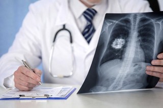 Proiectul "Prevenţie pentru toţi" - lansat la Facultatea de Medicină a UMF "Carol Davila"