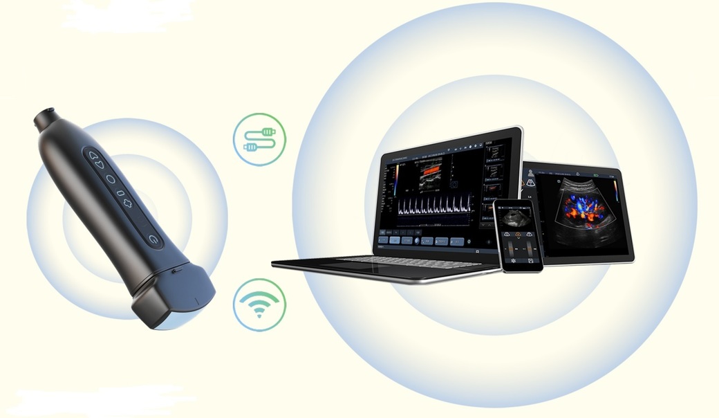 Compania Estima Medical Group lansează un ecograf de buzunar