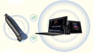 Compania Estima Medical Group lansează un ecograf de buzunar