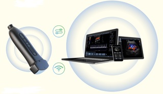 Compania Estima Medical Group lansează un ecograf de buzunar