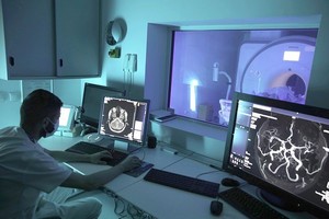 Tratament prompt pentru accident vascular cerebral la Spitalul Clinic SANADOR