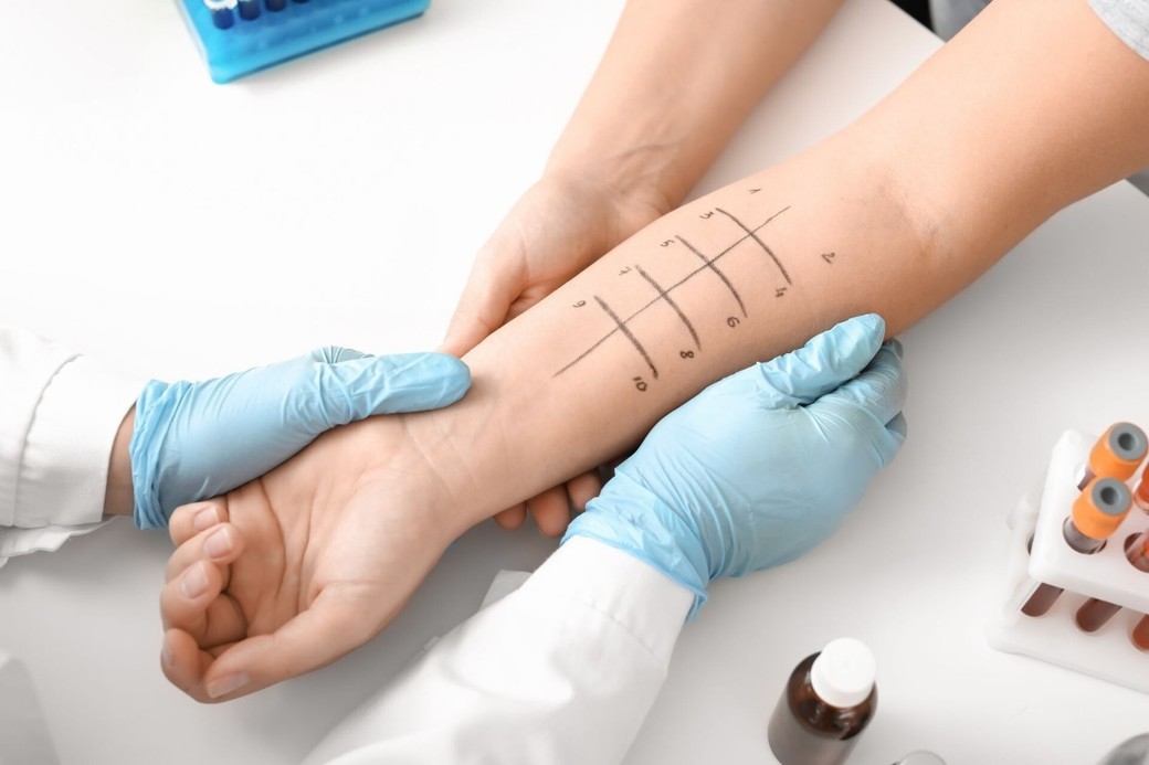 Diagnosticul corect al alergiilor la SANADOR