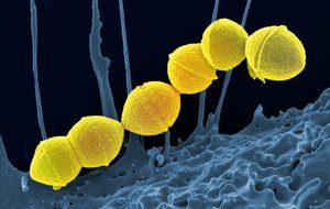 Infecţiile cu bacterii rezistente se răspândesc rapid la nivel mondial, avertizează OMS