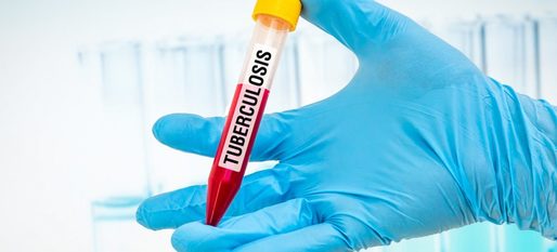 Tuberculoza a ucis peste 1,2 milioane de persoane anul trecut, potrivit unui nou raport al OMS