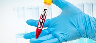 Un nou tratament ar putea accelera vindecarea tuberculozei