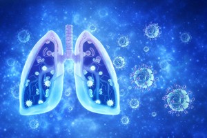 Compoziţia microbiotei intestinale poate influenţa riscul de pneumonie după infecţia gripală, sugerează un studiu