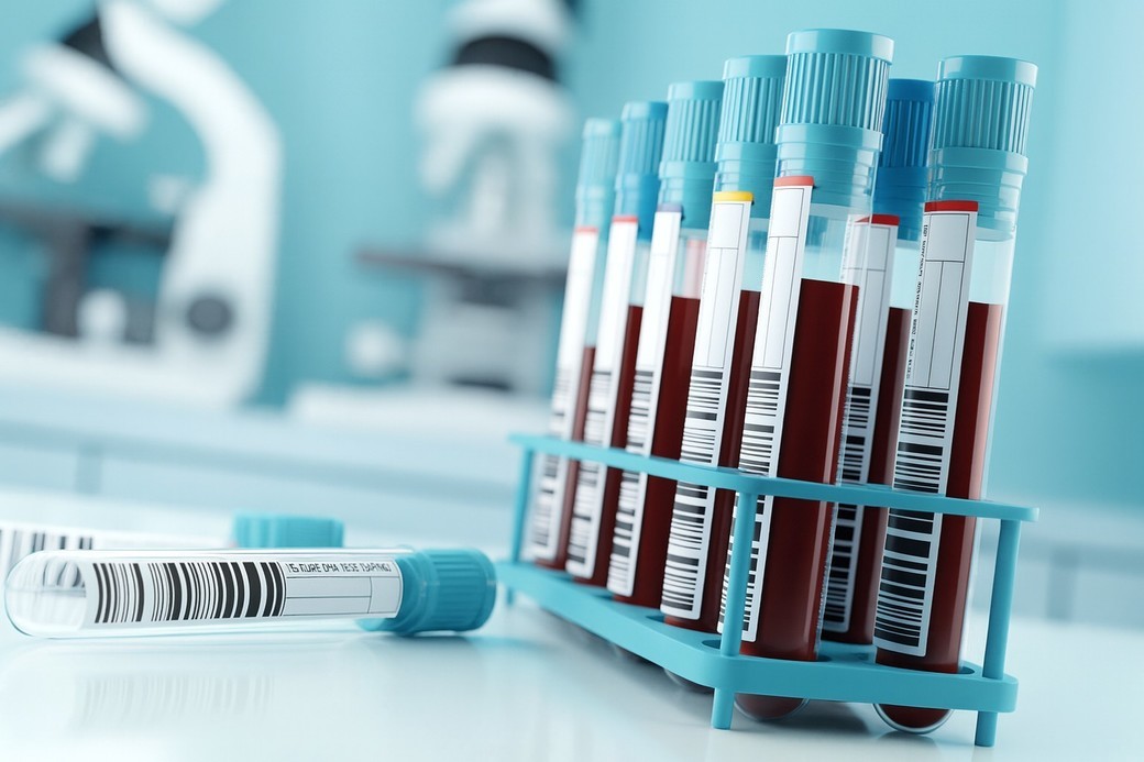 Markeri din sânge asociaţi cu leziuni pulmonare persistente la pacienţi post-Covid