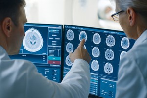 O tehnologie bazată pe AI triplează şansele de recuperare fără dizabilităţi după un AVC