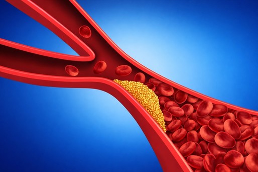 Un nou marker de risc cardiovascular: rolul proteinei C-reactive în evaluarea bolilor de inimă