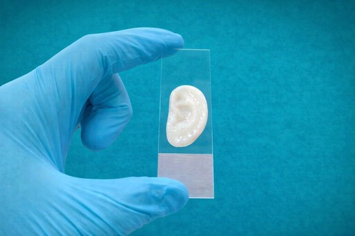 VIDEO Un nou progres în reconstrucţia urechii: cartilaj obţinut prin imprimare 3D, testat cu succes în modele animale