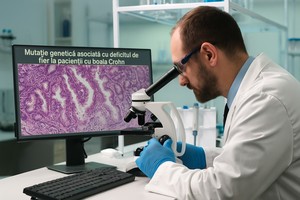 Mutaţie genetică, asociată cu deficitul de fier la pacienţii cu boala Crohn