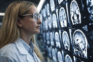 Progrese semnificative în dezvoltarea unui test de sânge capabil să identifice cancerul cerebral şi să urmărească evoluţia bolii