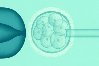 Testele genetice pentru evaluarea embrionilor în FIV ar putea supraestima anomaliile şi respinge embrioni sănătoşi, potrivit unui nou studiu