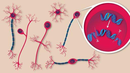 Editarea genetică direct în creier, o revoluţie în tratamentul bolilor neurologice 