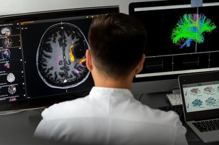 Boala Alzheimer ar putea debuta în centrul olfactiv din creier. Ce indică noi descoperiri