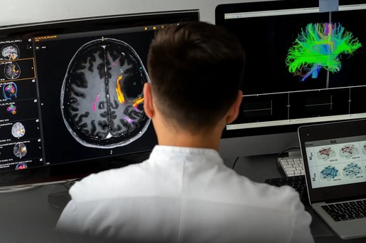 Boala Alzheimer ar putea debuta în centrul olfactiv din creier. Ce indică noi descoperiri