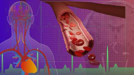 O metodă de imagistică inovatoare ar putea ajuta la diagnosticarea timpurie a demenţei şi bolii Alzheimer