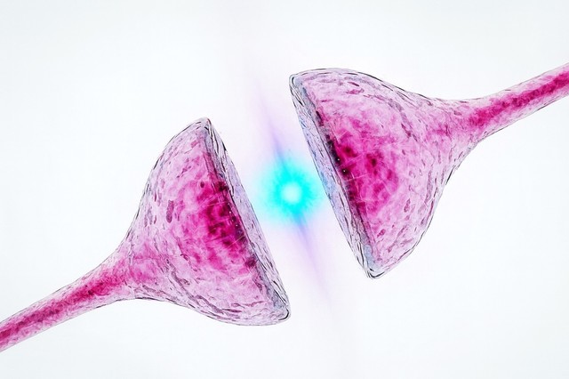 科学者によって特定された、アルツハイマー病の発症に関連する細胞欠陥