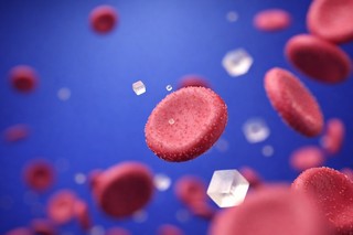 Glicemia crescută după masă, asociată cu un risc mai mare de boală Alzheimer