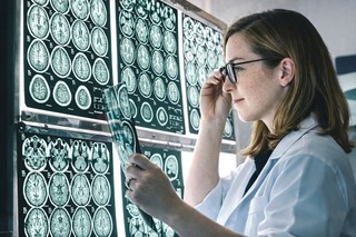 Noi dovezi că virusul Epstein-Barr are un rol direct în apariţia unei boli neurologice grave