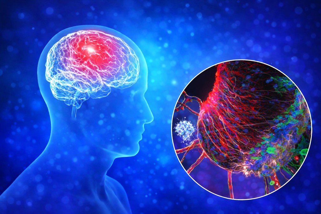 Alzheimer: descoperirea implicării unor noi tipuri de celule în apariţia şi evoluţia bolii
