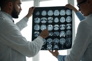 Cercetătorii au identificat o cauză genetică majoră pentru tulburările de neurodezvoltare recesive