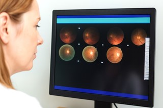 Scanarea retinei ar putea indica vârsta biologică şi riscul bolilor de inimă 