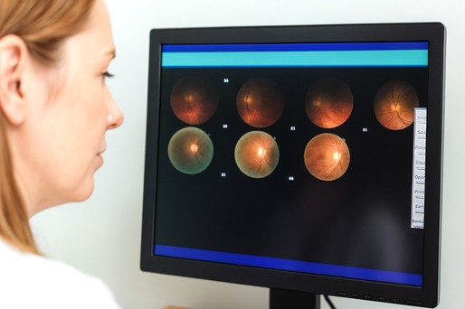 Scanarea retinei ar putea indica vârsta biologică şi riscul bolilor de inimă 