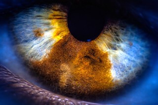 Prezenţa unei bacterii în retină, corelată cu declinul cognitiv şi Alzheimer