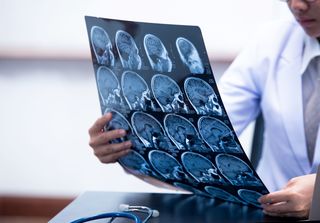 Un nou test de diagnostic indică pacienţii cu cancere din sfera ORL care pot fi vindecaţi doar prin chirurgie