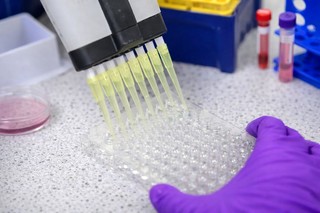 O legătură neaşteptată între sistemul imunitar şi menţinerea sănătăţii oaselor