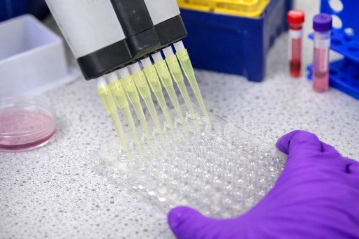 O legătură neaşteptată între sistemul imunitar şi menţinerea sănătăţii oaselor