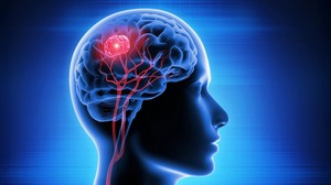 Radiografiile color de înaltă rezoluţie ar putea permite depistarea precoce a cancerului