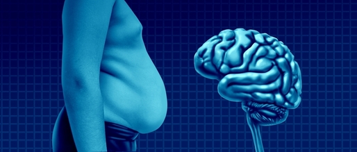 Obezitatea, asociată cu o progresie mai rapidă a semnelor biologice din boala Alzheimer