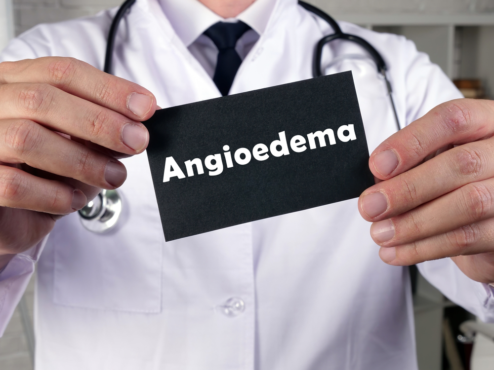 Un medicament cu administrare orală pentru angioedem ereditar, autorizat în SUA