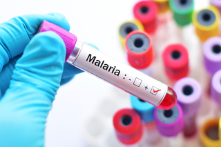Primul medicament împotriva malariei autorizat pentru copiii mici
