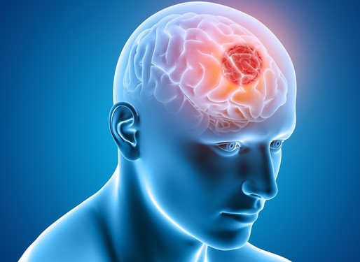 Enzima care ar putea opri creşterea celor mai agresive tumori cerebrale