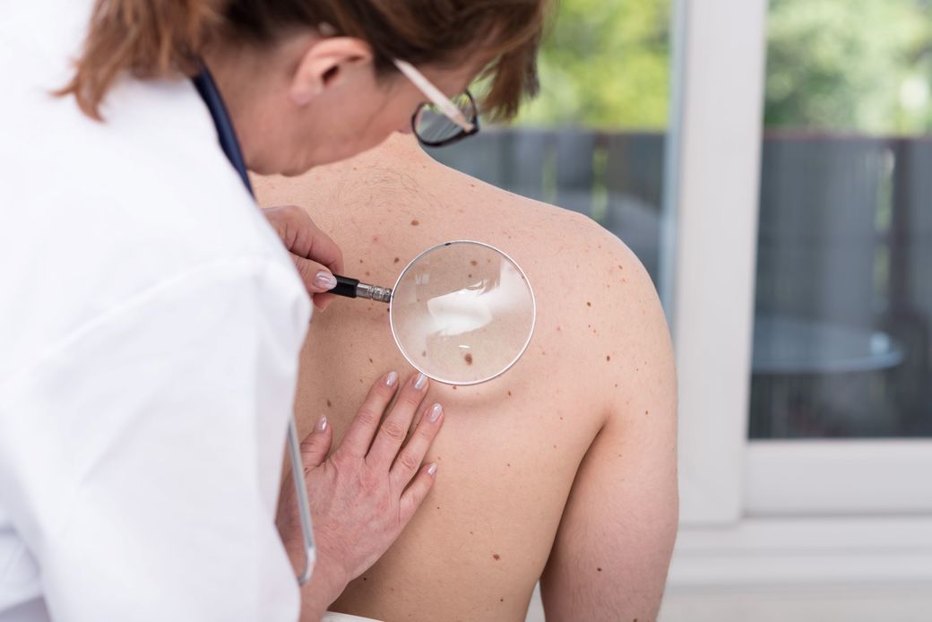 Îmbătrânirea populaţiei şi explozia cazurilor de cancer de piele la bărbaţii vârstnici