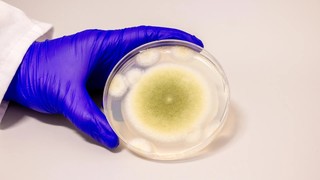 O toxină letală descoperită într-un mormânt antic oferă o soluţie terapeutică împotriva leucemiei