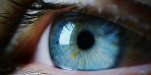Asociaţia Melanom România solicită Guvernului compensarea singurului tratament autorizat la nivel mondial pentru melanomul ocular