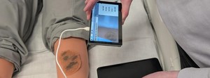 Tehnologia care poate transforma accesul la îngrijirea dermatologică în zone defavorizate