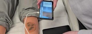 Tehnologia care poate transforma accesul la îngrijirea dermatologică în zone defavorizate
