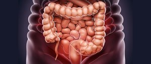 Când poate fi declarat vindecat cancerul colorectal?