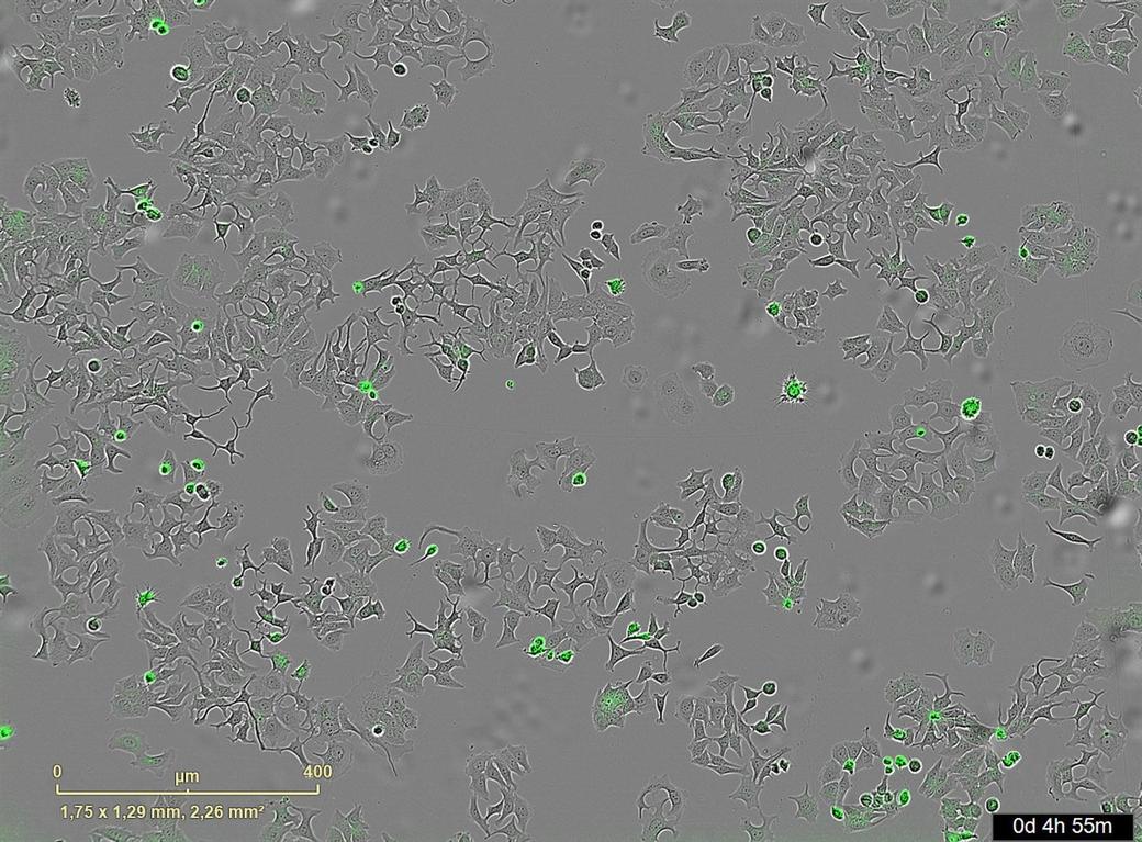 Cercetătorii au descoperit o bacterie care face celulele canceroase să se autodistrugă
