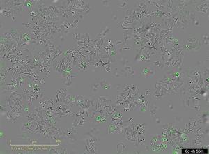 Cercetătorii au descoperit o bacterie care face celulele canceroase să se autodistrugă
