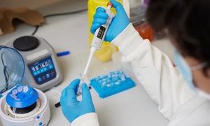 Test de sânge pentru anticiparea răspunsului la tratament în cancerul ovarian